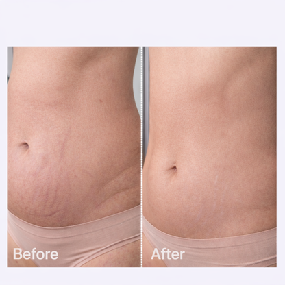 Anti-Cellulite Massage Oil Infused Collagen & Stem Cell