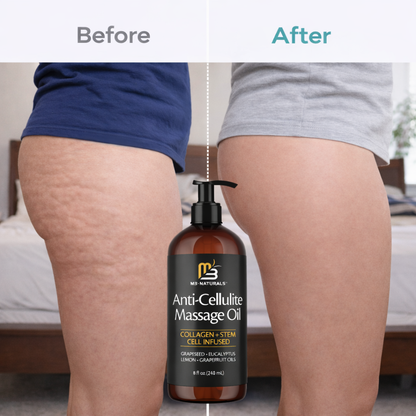 Anti-Cellulite Massage Oil Infused Collagen & Stem Cell
