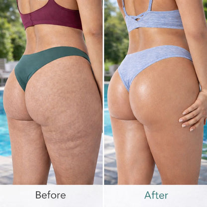 Anti-Cellulite Massage Oil Infused Collagen & Stem Cell